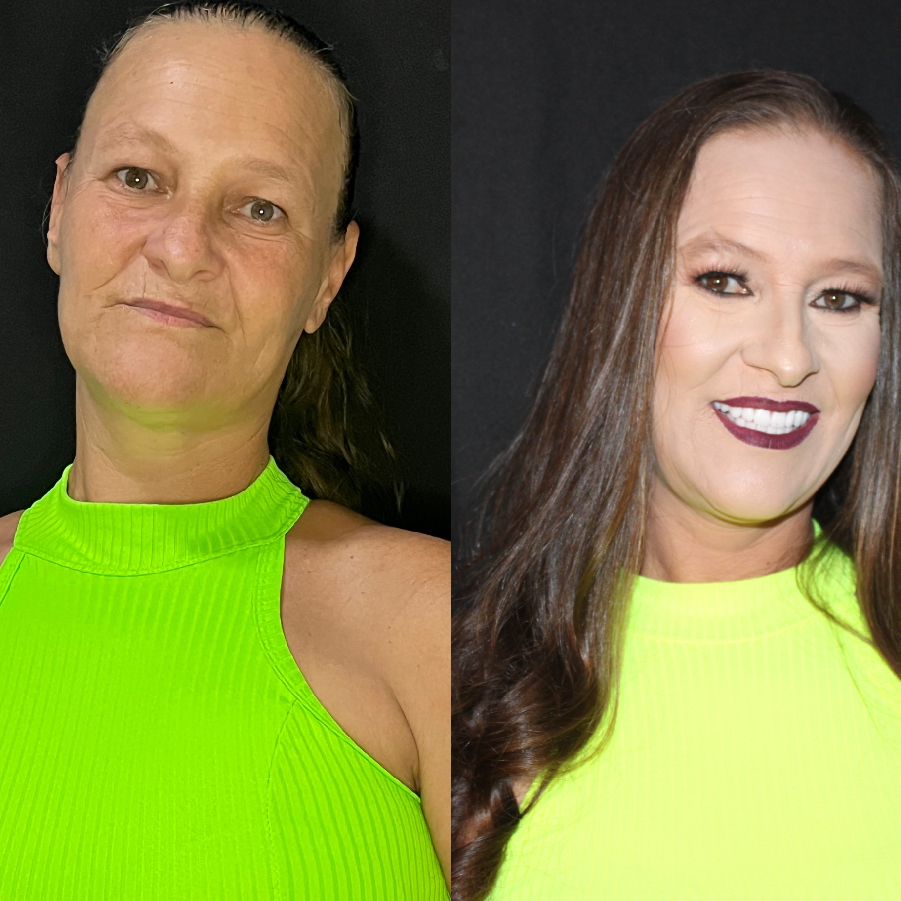Antes e depois — Estética + Reabilitação
