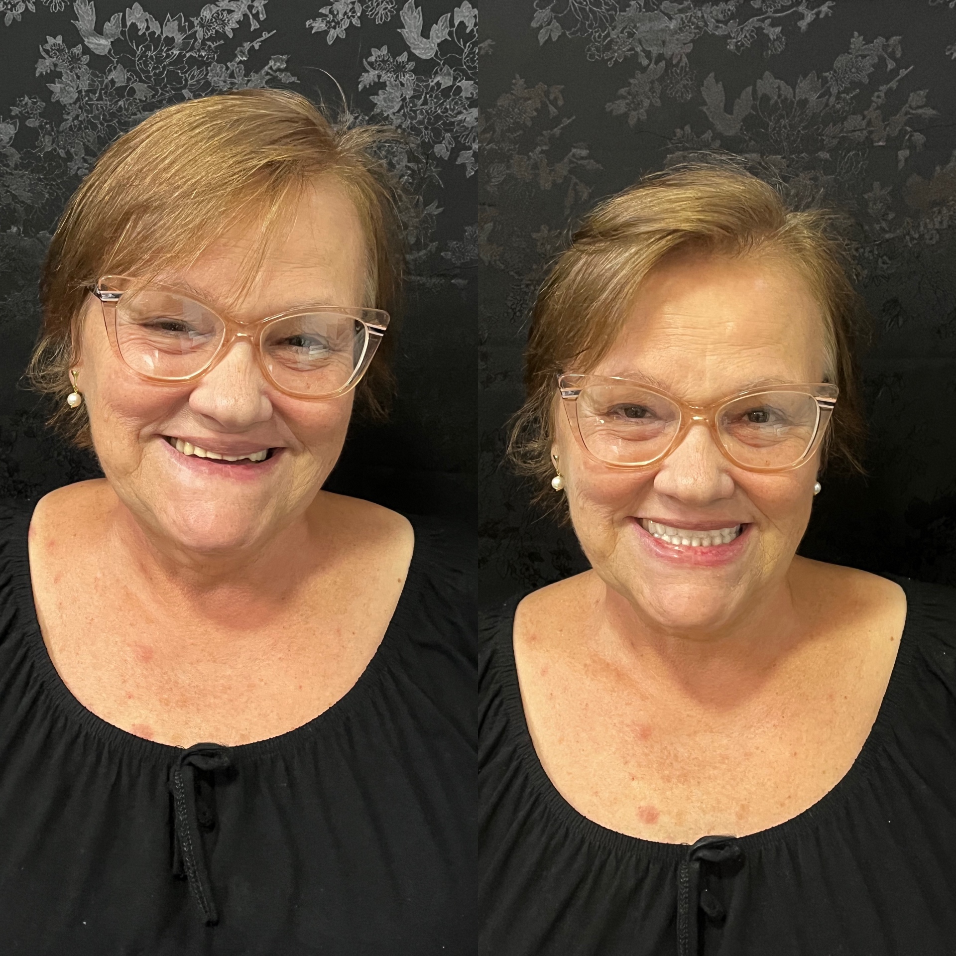 Antes e depois — Reabilitação Estética